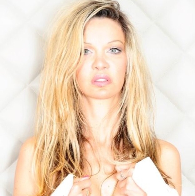 Alicia Douvall has too much plastic surgery