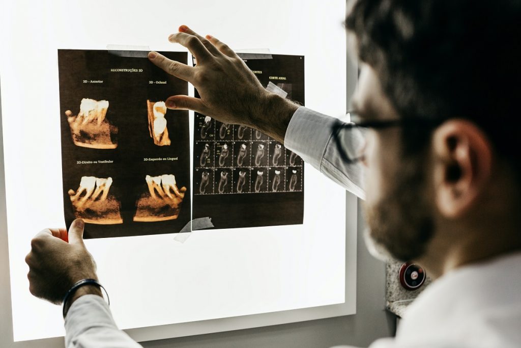 How Often Should You Go For A Dental Check-Up