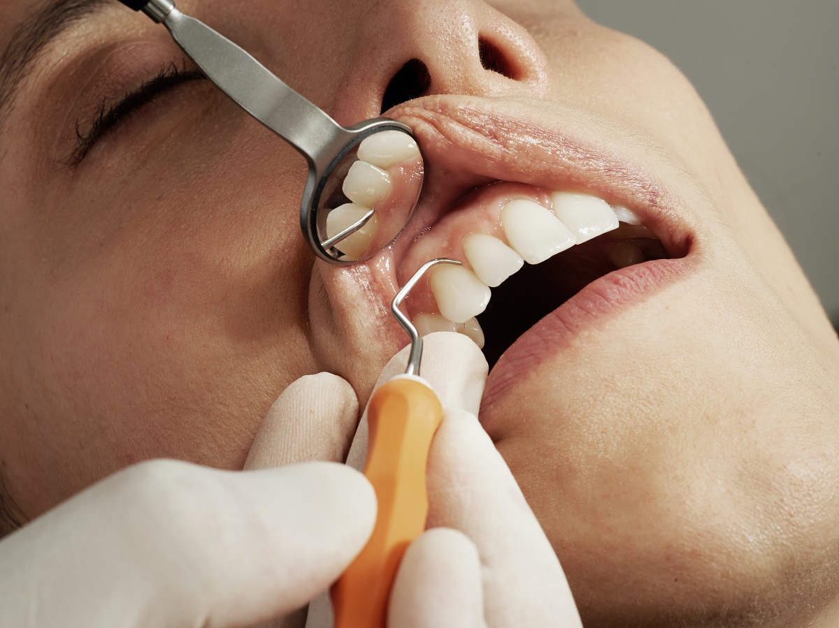 How Often Should You Go For A Dental Check-Up