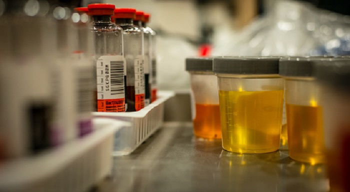 Compelling Reasons for Drug Testing in The Workplace